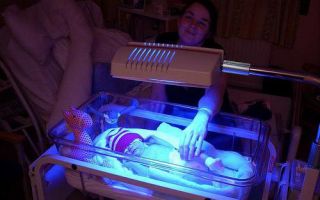 Норма билирубина у новорожденных 1 месяц